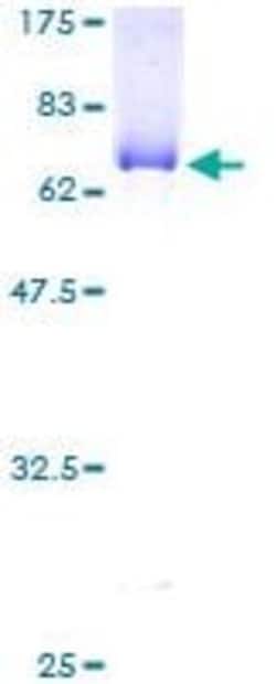 Abcam Recombinant Human Abhd5/CGI-58 protein, 10UG, Quantity: Each of 1