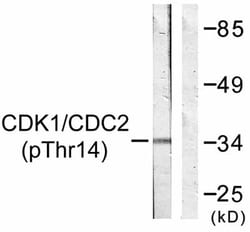 Abcam Rabbit polyclonal to CDK1 (phospho T14), Quantity: Each of 1