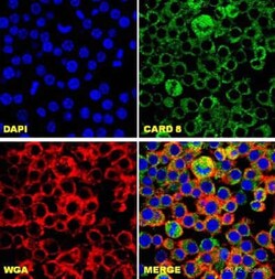 Abcam Rabbit polyclonal to CARD8, Quantity: Each of 1