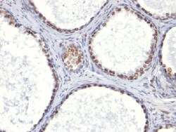 Abcam Mouse monoclonal [AR441] to Androgen Receptor, Quantity: Each of