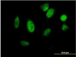 Abcam Mouse polyclonal to Id1, Quantity: Each of 1