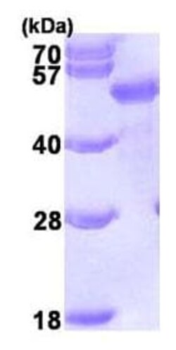 Abcam Recombinant Human SQSTM1 / p62 protein, 100UG, Quantity: Each of