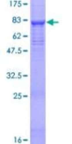 Abcam Recombinant Human SPAM1 protein, 2UG, Quantity: Each of 1