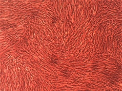 Cell Systems Corporation Primary Human Lung Fibroblast Cells (ACBRI 469