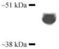 Abcam Rabbit polyclonal to Cytochrome P450 3A4/CYP3A4, Quantity: Each of