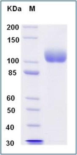 Abcam Recombinant human ACE2 protein (His tag), Quantity: Each of 1