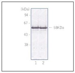 Abcam Mouse monoclonal [NVGC-01] to Norovirus Capsid protein VP1, Quantity: