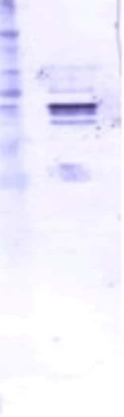 Abcam Mouse monoclonal [7B10] to Mumps nucleoprotein, Quantity: Each of