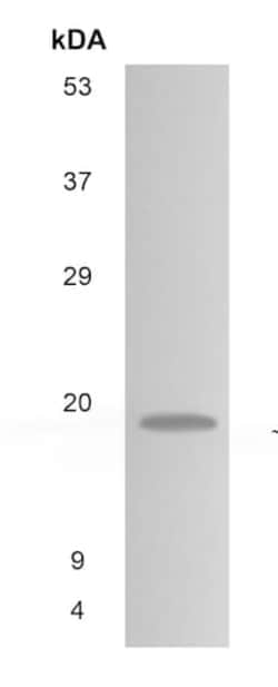 Abcam Mouse monoclonal [MM0361-9T27] to IL-11, Quantity: Each of 1