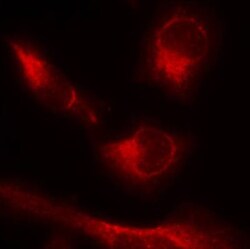 Abcam Rabbit polyclonal to Tau (phospho S356), Quantity: Each of 1