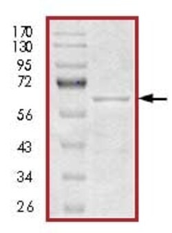 Abcam Recombinant Human Tau441 protein, 50UG, Quantity: Each of 1