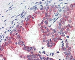 Abcam Goat polyclonal to ROR1, Quantity: Each of 1
