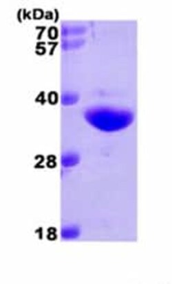 Abcam Recombinant Human NQO1 protein, Quantity: Each of 1