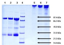 Abcam Native Human IgM protein, 1MG