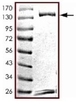 Abcam Recombinant Human STAT6 protein, Quantity: Each of 1