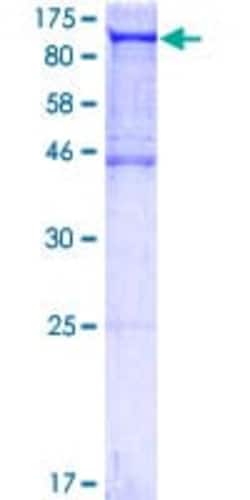 Abcam Recombinant Human ALIX protein, 10UG, Quantity: Each of 1
