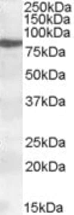 Abcam Goat polyclonal to 15 Lipoxygenase 1, Quantity: Each of 1