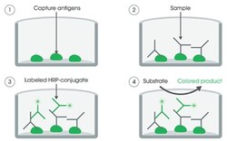 Abcam Human Anti-Cytomegalovirus IgM ELISA Kit (CMV), 1 x 96 Tests, Quantity: