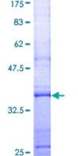 Abcam Recombinant Human Lysozyme protein, 10UG, Quantity: Each of 1