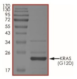 Abcam Recombinant Human KRAS (mutated G12D) protein (Tagged-His Tag), Quantity:
