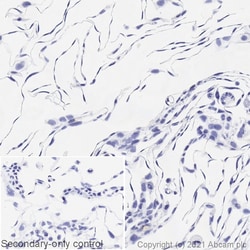 Abcam Mouse monoclonal [VE1] to BRAF (mutated V600E), Quantity: Each of