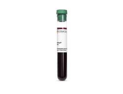 STEMCELL Technologies&nbsp;Solid Tumor Cancer, Hu PB, EDTA, Fresh, Size: 1 Collection