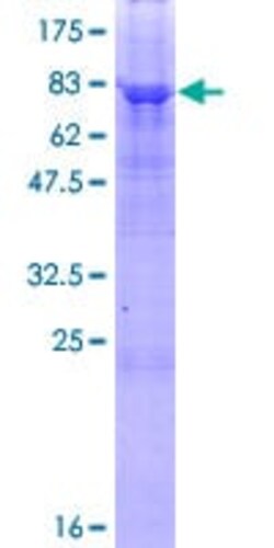Abcam Recombinant Human PNPLA3 protein, 10UG, Quantity: Each of 1