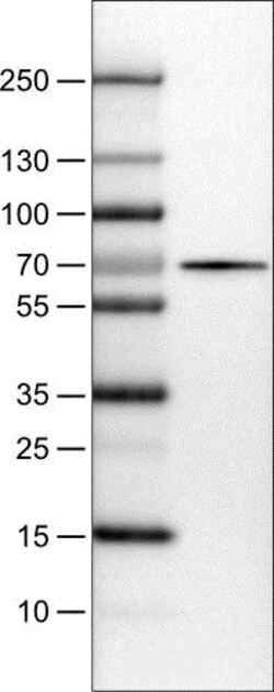 Abcam Mouse monoclonal [CL0213] to SLC27A5/BAL, Quantity: Each of 1