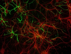 Lonza Walkersville Mouse C57 Brain Cortex Neurons, Quantity: Each of 1