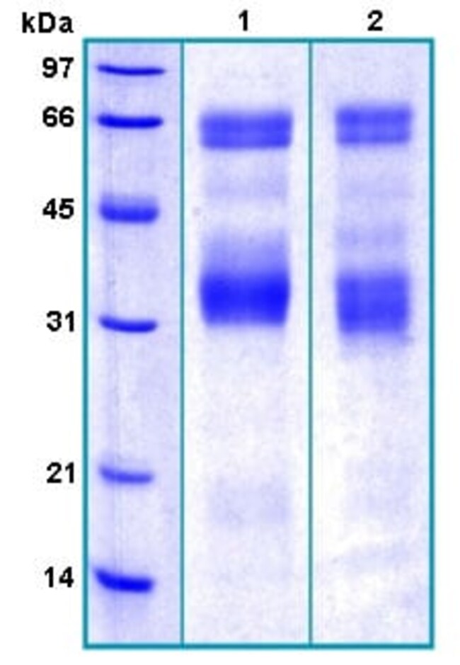 Abcam Human PSAP protein 100ug, Quantity Each of 1