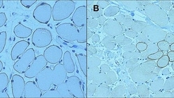 Leica Biosystems LYOPHILIZED MOUSE ANTIBODY, Quantity: Each of 1