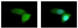 Abcam Rabbit polyclonal to ABCB11/BSEP, Quantity: Each of 1