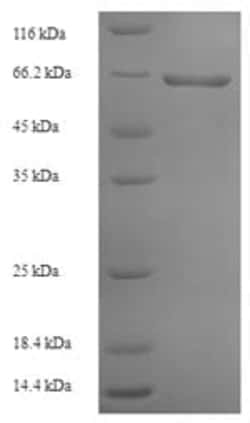 Abcam Recombinant Rabies Virus Glycoprotein (His tag), 100UG, Quantity:
