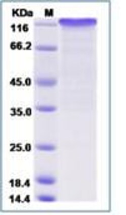 Abcam Recombinant Human Notch1 protein (Fc Chimera), 50UG, Quantity: Each