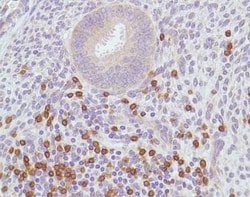Abcam Rabbit monoclonal [SP7] to CD3, prediluted, Quantity: Each of 1