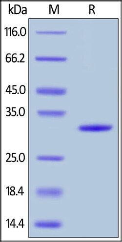 Abcam Recombinant Human Galectin 3 protein (His tag), 200UG, Quantity: