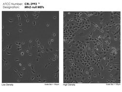 MFN2-NULL MEFS/ CRL-2993 ATCC