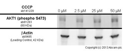 Abcam CCCP, Mitochondrial o x idative phosphorylation uncoupler, 500MG,