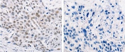 Abcam Rabbit polyclonal to MURF1, Quantity: Each of 1