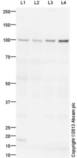 Abcam Rabbit polyclonal to TNNI3K, Quantity: Each of 1