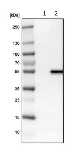 Abcam Rabbit polyclonal to LPCAT-2, Quantity: Each of 1