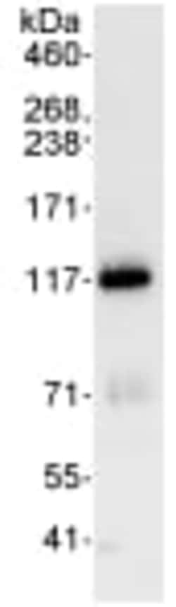 Abcam Rabbit polyclonal to KIF18A, Quantity: Each of 1