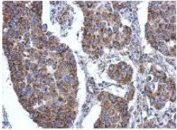 Abcam Anti-ACSL3 antibody (ab151959) 100ul, Quantity: Each of 1