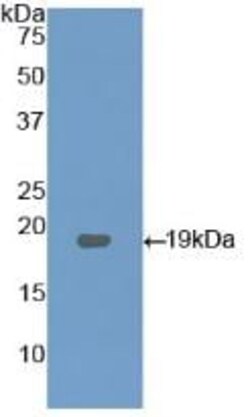 Abcam Anti-LPCAT3 antibody (ab232958) 100ug, Quantity: Each of 1