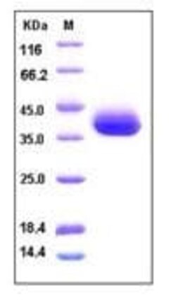 Abcam Recombinant human SFRP1 protein (His tag), 50UG, Quantity: Each of