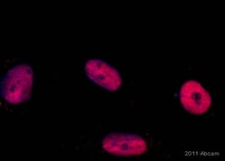 Abcam Anti-RUNX1 / AML1 antibody, Quantity: Each of 1