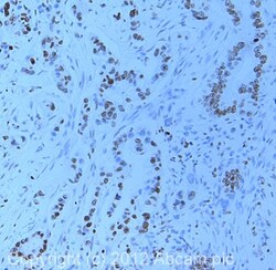 Abcam Anti-Histone H4 (di methyl K20) antibody, Quantity: Each of 1