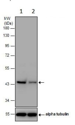 Abcam Anti-Glutamine Synthetase antibody, Quantity: Each of 1