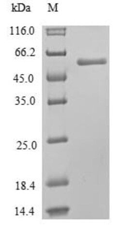 Abcam Recombinant Human MLKL protein (His tag), 100UG, Quantity: Each of