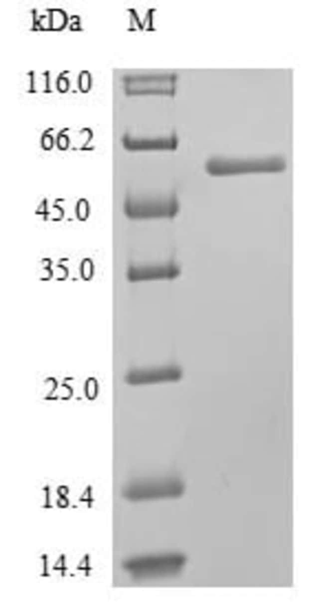 Abcam Human MLKL protein (His tag) (ab239569) 100ug